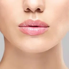 Dermal fillers Treatment for Lips